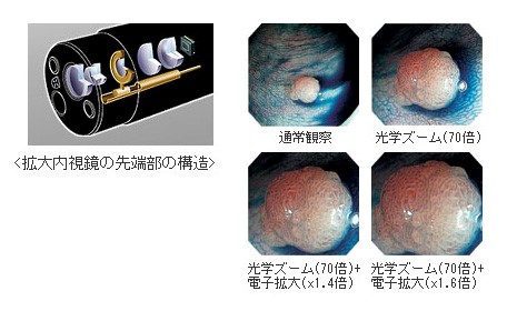 新しい医療機器と、確かな技術